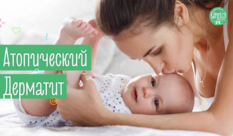 Атопічний Дерматит у Дітей | Причини, Допомога та Лікування | Family is ...